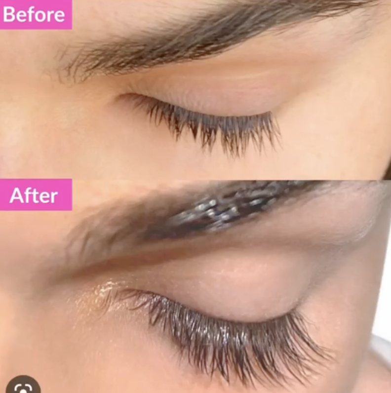 Eyelashes before and after Latisse