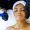 Microneedling 1